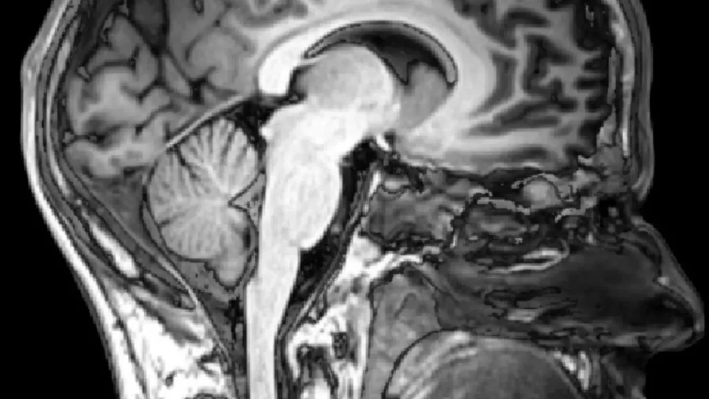 How the Blood–Brain Barrier Controls What Reaches the Brain featured reference image