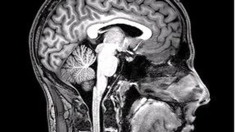 What Causes Déjà Vu? — documentary reference image
