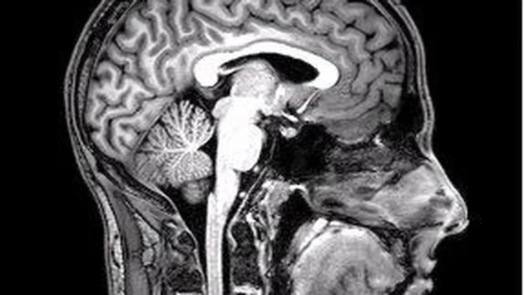 How the Brain Predicts What You Are About to Perceive featured reference image