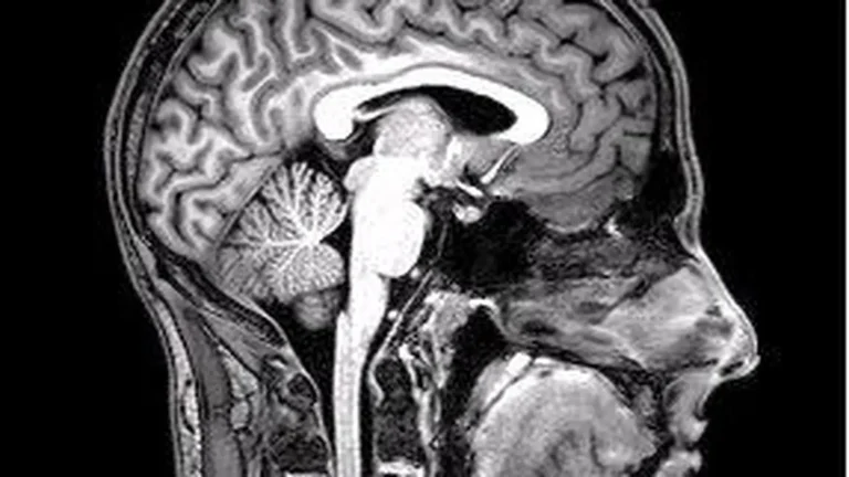 How the Brain Predicts What You Are About to Perceive featured reference image
