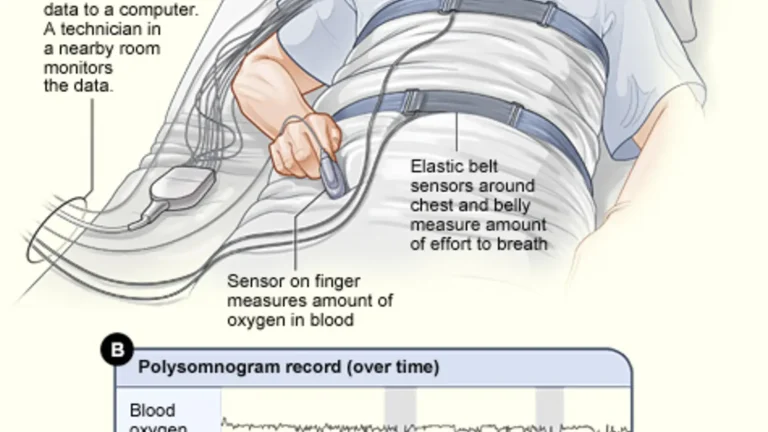 Sleep-study participant resting while physiological signals are recorded