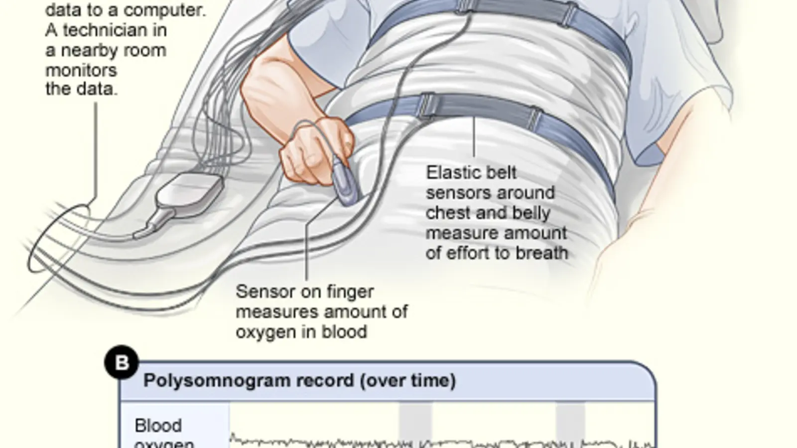 Sleep-study participant resting while physiological signals are recorded