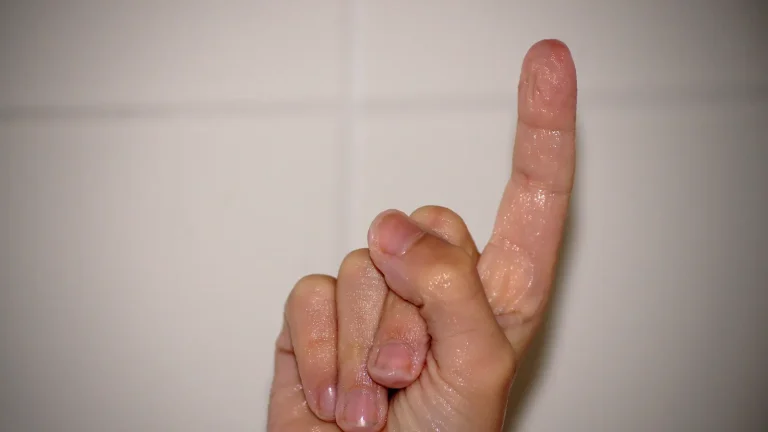 Close view of fingertips wrinkled after prolonged exposure to water